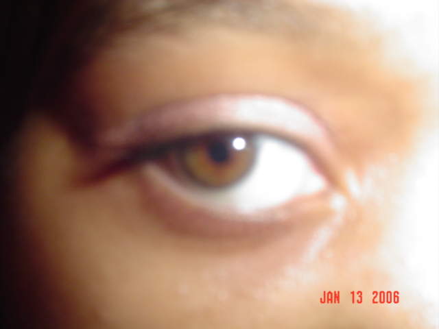 My lovely eye!