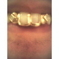  Show yo Grill if u real! (Detachable)