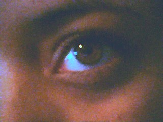 My eye