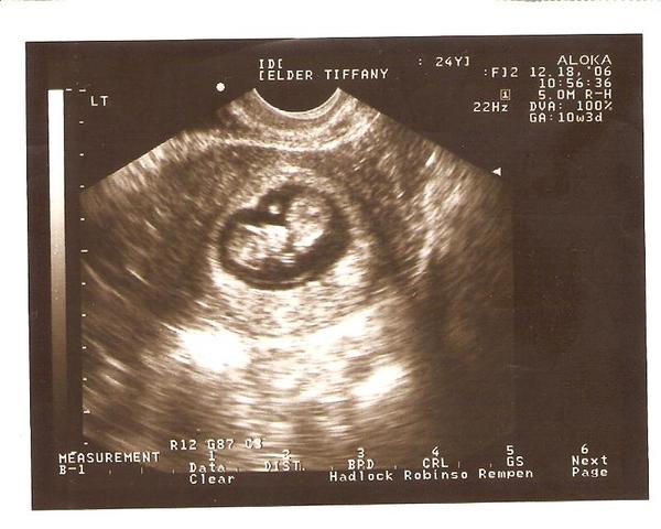 Future President of the World!!!