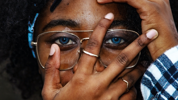 How to Handle Acne as a College Student