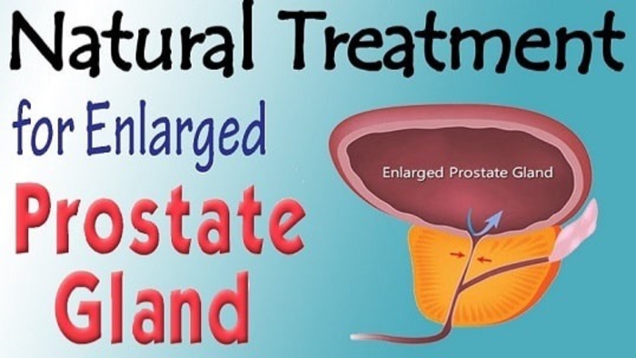 Prostate enlargement: symptoms, causes, and cures