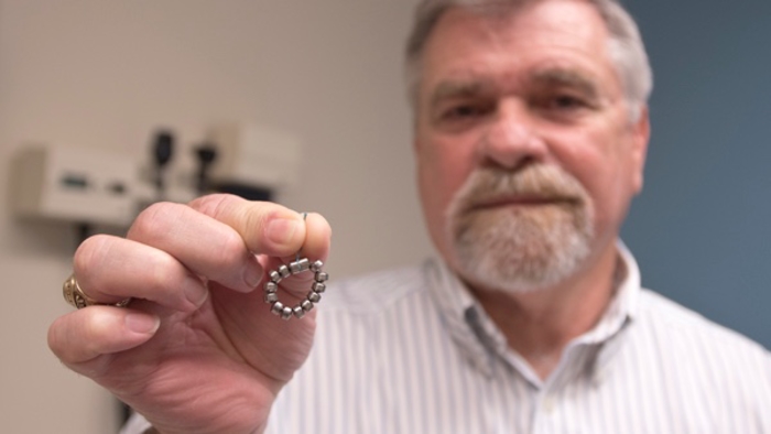 Acid reflux procedure eases years of pain